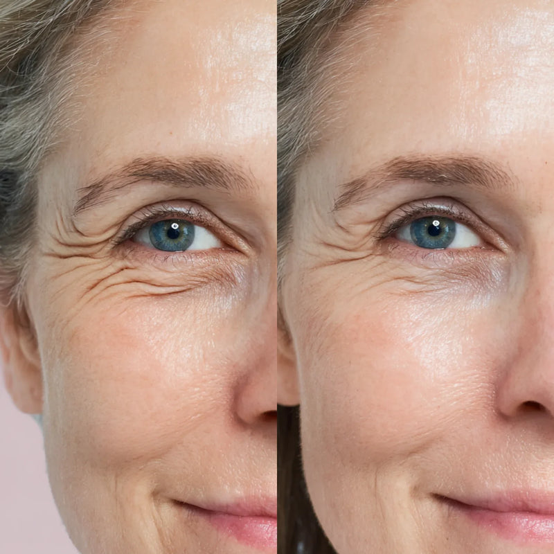 Clinical results